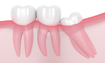 Cirugía Maxilofacial