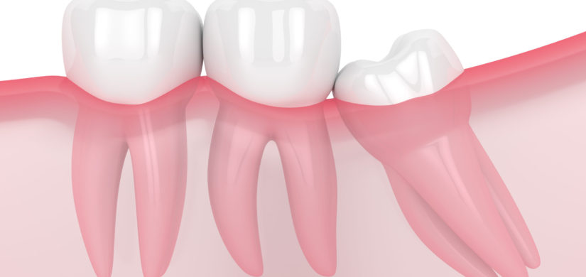 Cirugía Maxilofacial