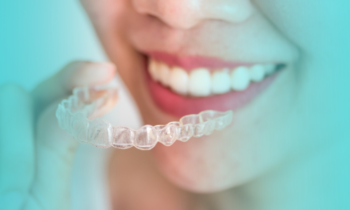 Invisalign: 4 razones para comenzar a utilizar este novedoso tratamiento de ortodoncia