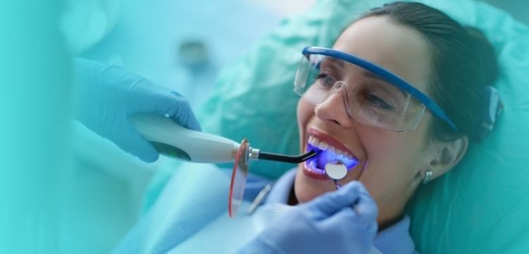 ¿Qué es un sellado dental y cuándo es necesario?