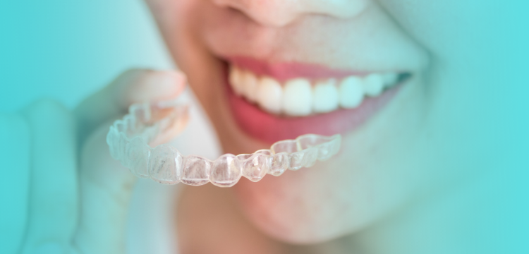 Invisalign: 4 razones para comenzar a utilizar este novedoso tratamiento de ortodoncia