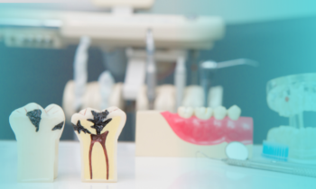 Qué ocurre si te han hecho mal una endodoncia