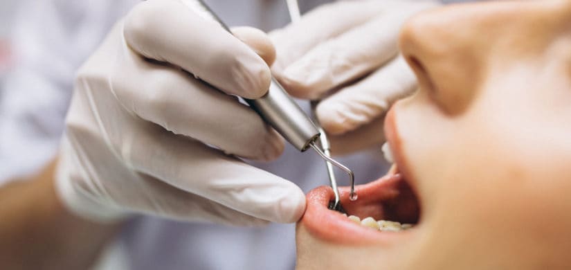 Revisión dental con instrumental durante una endodoncia